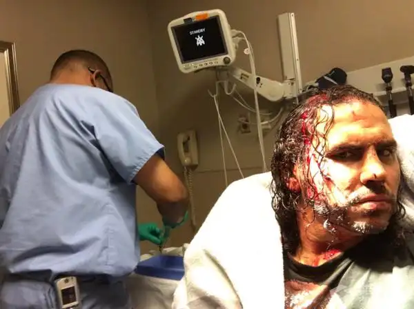 马特·哈迪被爆头,血流满面!