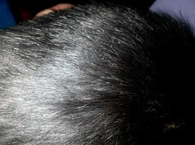 我该怎么办我不会白头偕老吧,不会提前老化吧不会.