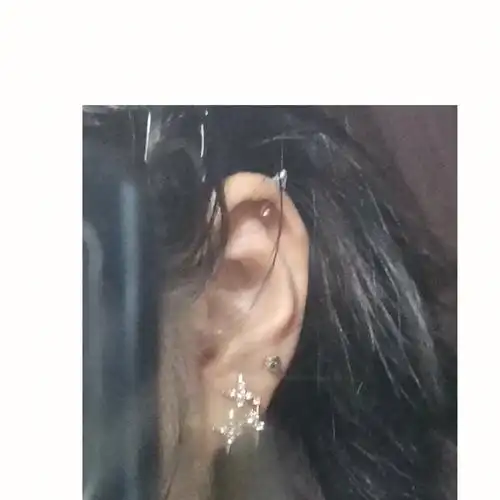 每一个打了耳轮的人都需要一个u型枕