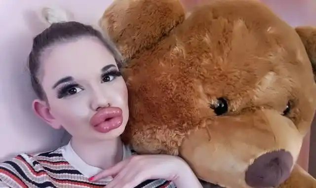 国外女子疯狂丰唇21次超大腊肠嘴快能碰到鼻子网友辣眼睛