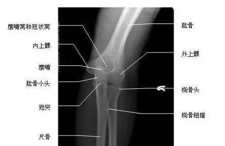 为了明白肘关节疼痛的原因,我们需要先了解一下肘关节的结构和功能.