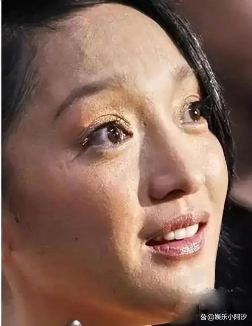 周迅频繁熬夜拍戏,加上平日抽烟的习惯,导致她的脸上出现了难以掩盖的