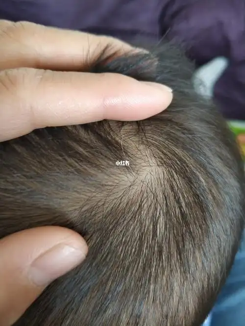 可爱的娃居然有一根白头发,神马情况?