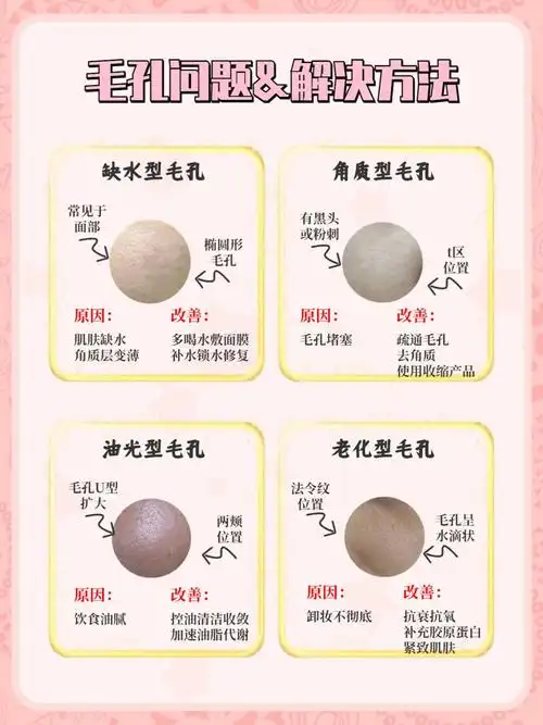 分清毛孔粗大类型,正确护肤6015