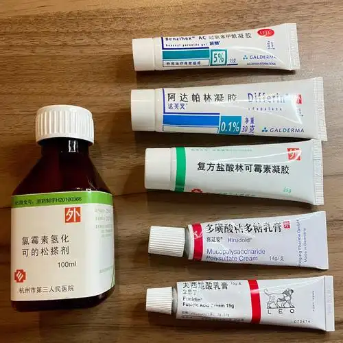 祛痘祛粉刺药膏大合集