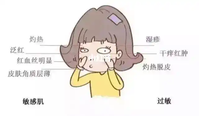 敏感肌皮肤困扰