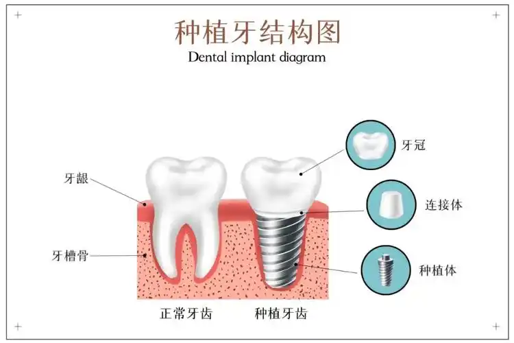 7月4日原光华口腔种牙专家曾融生教授坐诊圣贝 - 知乎
