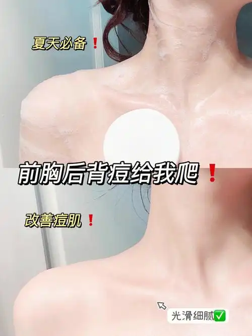 用且初果酸沐浴露不再受小疙瘩后背痘的气