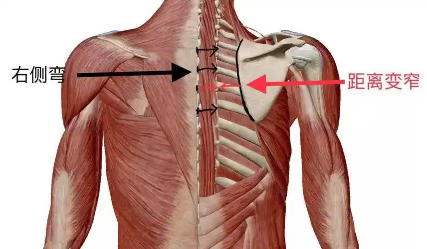 肩胛骨缝痛总治不好是怎么回事