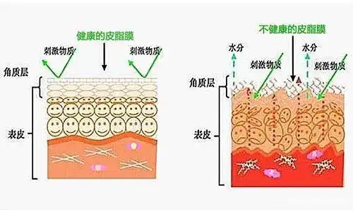 健康的皮脂膜和受损的皮脂膜比较
