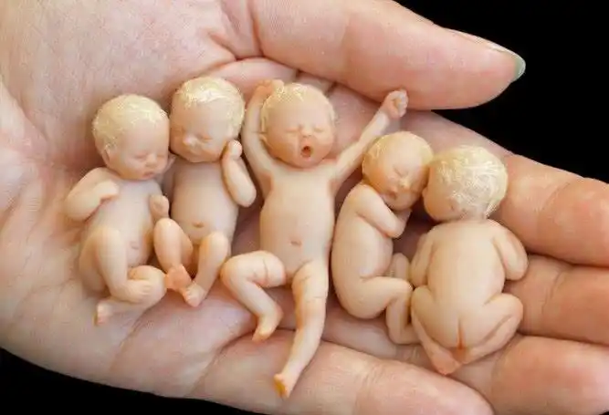 婴儿刚出生时,一般都会有40到50厘米,但这5个小宝宝只有3厘米,躺在