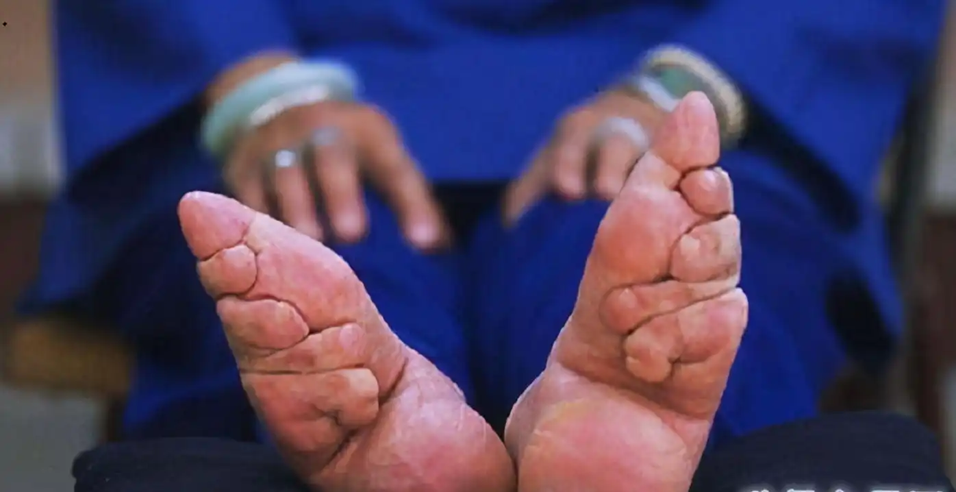 女子自幼裹脚,16岁嫁入豪门,洗脚避旁人,90年来仅丈夫见过双足