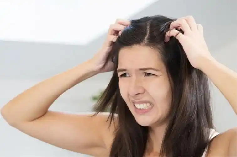 头皮发痒是什么原因,教你处理办法!