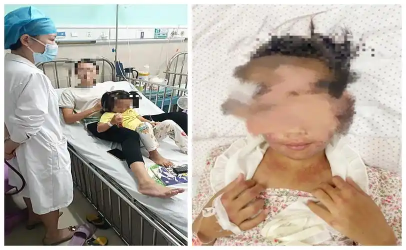 几天前小文开始四肢浮肿,全身肌肉,关节疼痛,肢体乏力,不能走路.