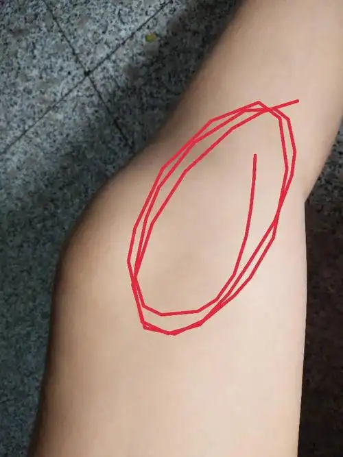 膝盖内测疼 一弯曲或者重心都放在那个腿上就会疼 时有时无的 刺痛