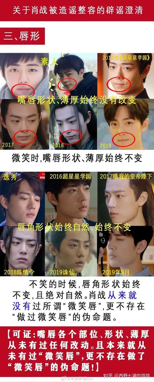 肖战整容了? - 知乎