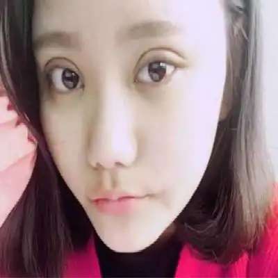 7毫米平行双眼皮案例!你也有拥有最自然的双眼皮_整形案例_美丽无忧网