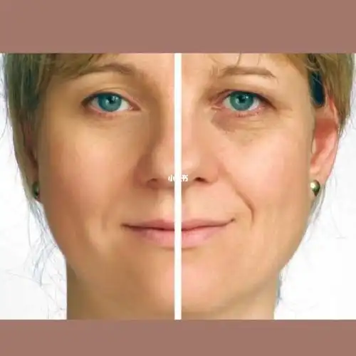 衰老的皮肤如何变紧致