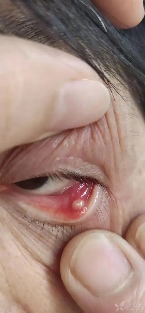 眼睛里长了东西