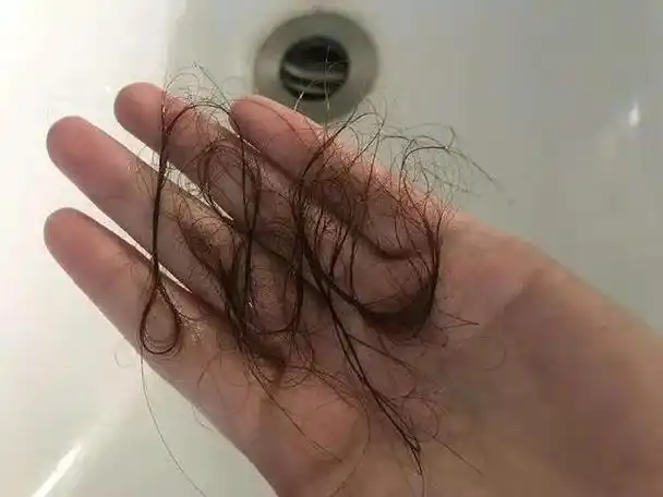 女生经常掉头发是什么原因(或与这5种因素有关)