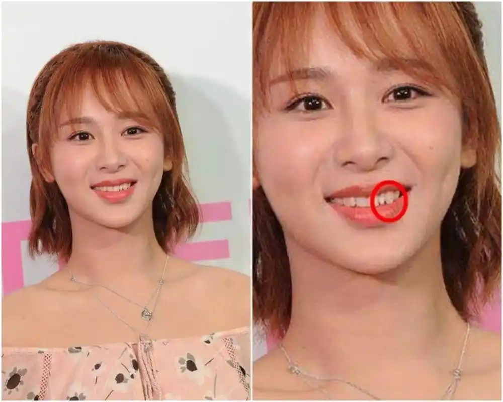 原创唐嫣美貌有人继承了说自己只动了牙齿但彭小苒撞脸多个女明星