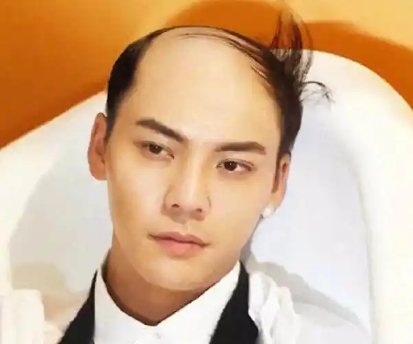 有刘海就别说颜值高了这7位明星告诉你光头造型照样能打