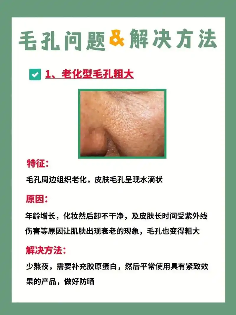 毛孔问题和解决方法.|||毛孔粗大是很多姐妹都有的皮肤问题, - 抖音