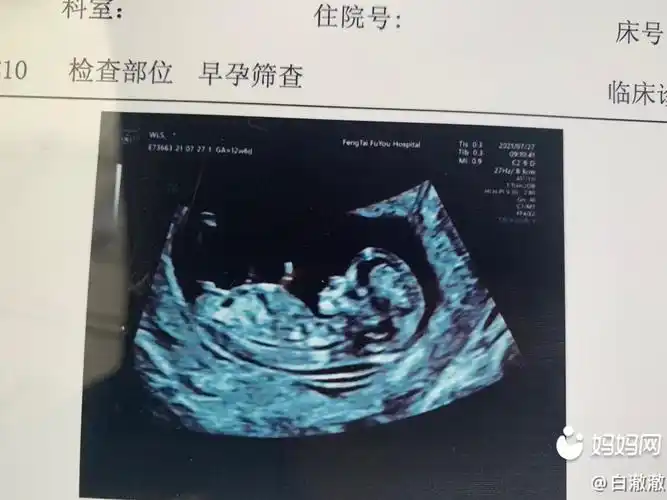 9mm 第三张无创 第一胎女宝 第二胎反应如下    前期不爱吃油爱吃酸