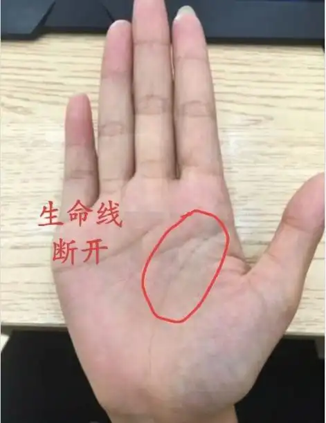 抗病能力差,一点小感冒都会难受几个星期,如果生命线有断开迹象,可能