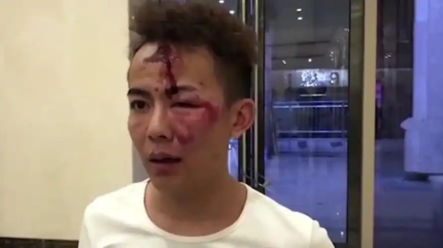 凌晨酒吧发生斗殴男子被打的头破血流监控记录打人一幕