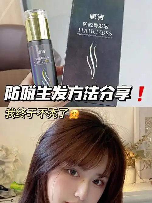 防脱生发方法真实分享我终于不秃了