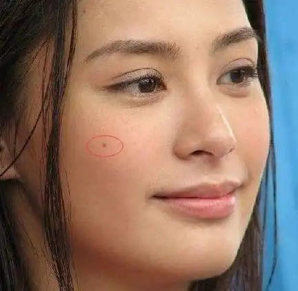 有美人痣的女明星,孙俪霸气,阿娇被赞,杨丞琳的最可爱