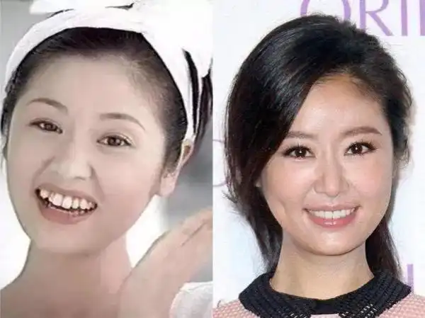 想不到紫薇格格当年也是牙齿不齐的一位,不过相较下来,林心如的牙齿并