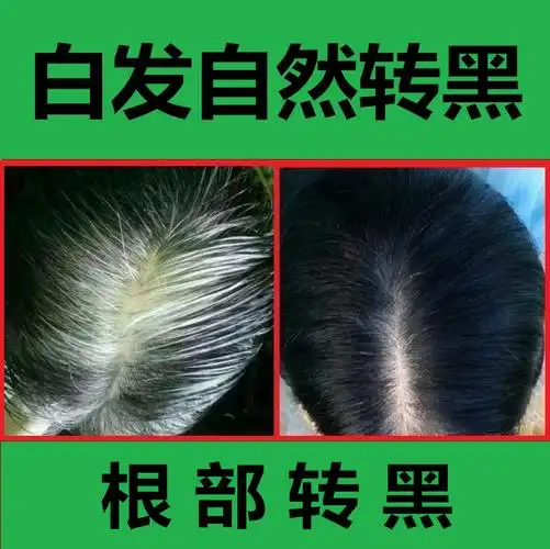 产后少年白发转黑发白发变黑少白头养黑发纯植物何首乌洗发水