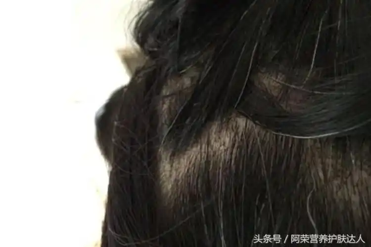 白发真的拔一根长十根吗?白头发长在这里最危险