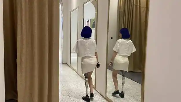 车祸残疾被甩,变身超帅赛博女孩|截肢|假肢|残肢|左臂_网易订阅