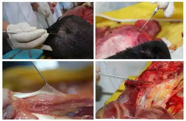 没有解剖学就没有医学2019年1月12日全国第十一届深圳新鲜尸体解剖班