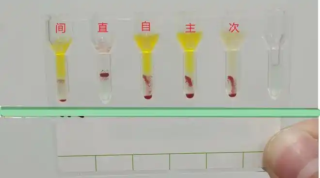 明知山有虎,偏向虎山行|红细胞|溶血性贫血|输血|白细胞_网易订阅