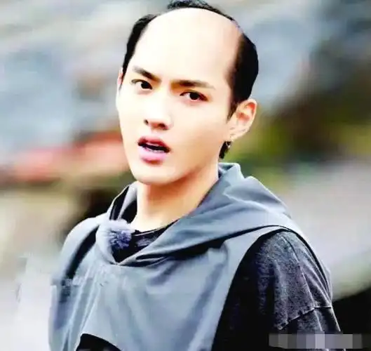 秃顶才是检验男明星颜值的唯一标准
