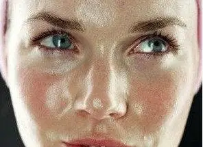 脸部一出油就洗脸好吗夏季造成皮肤出油的原因分析