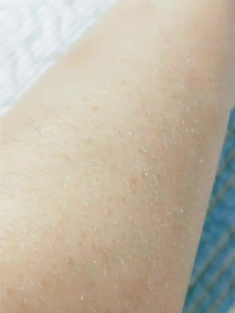 强烈推荐给干皮的妹子们 #护肤#皮肤干燥#秋冬身体乳 - 抖音