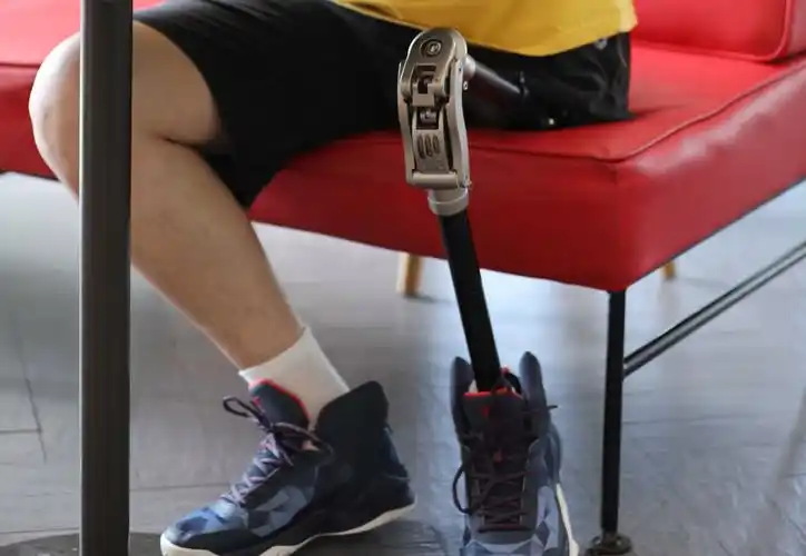 行业新闻 - 优邦假肢矫形器(上海)有限公司