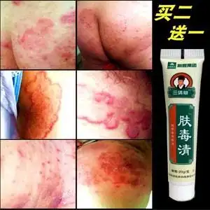 皮肤股藓成人股癣膏大腿内侧银屑病湿疹止痒外用牛皮癣药膏