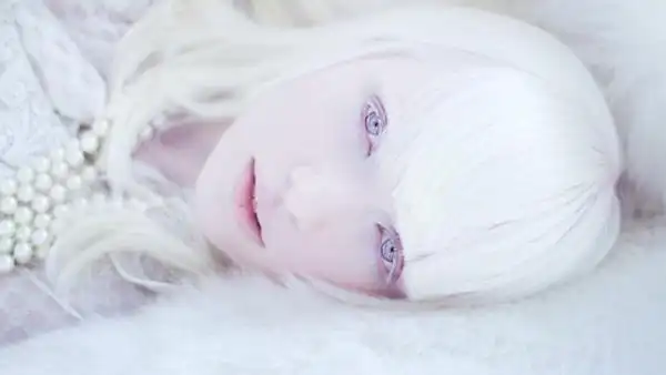 有很白的妹子,但是要肤白如雪(白雪),那就只有白化病人和浓妆了