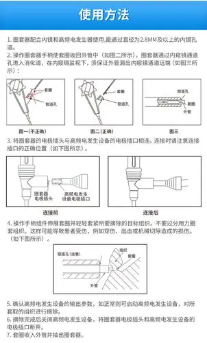 南京微创 一次性使用圈套器 φ28mm×2300mm(100支/箱)