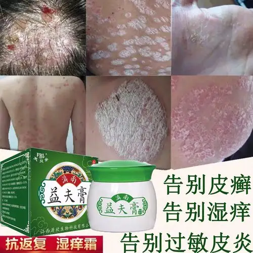 搜索"去癣膏皮肤外用"的优惠券结果页-淘宝优惠券查询系统