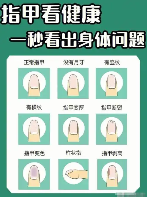 自测通过指甲看健康