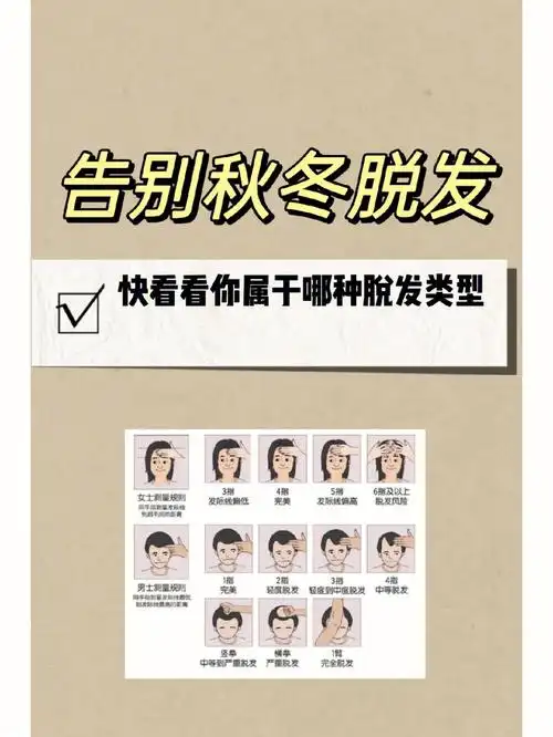 告别秋冬脱发季74你属于哪种类型的脱发