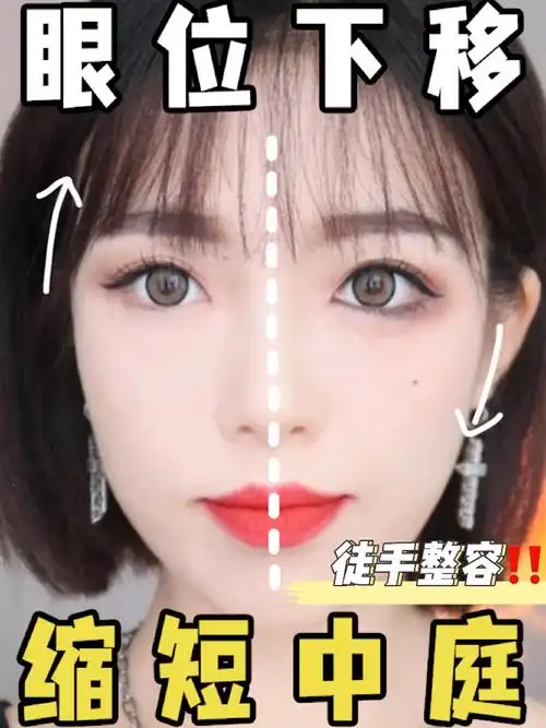 缩中庭大法长脸变短眼位下移减龄显嫩