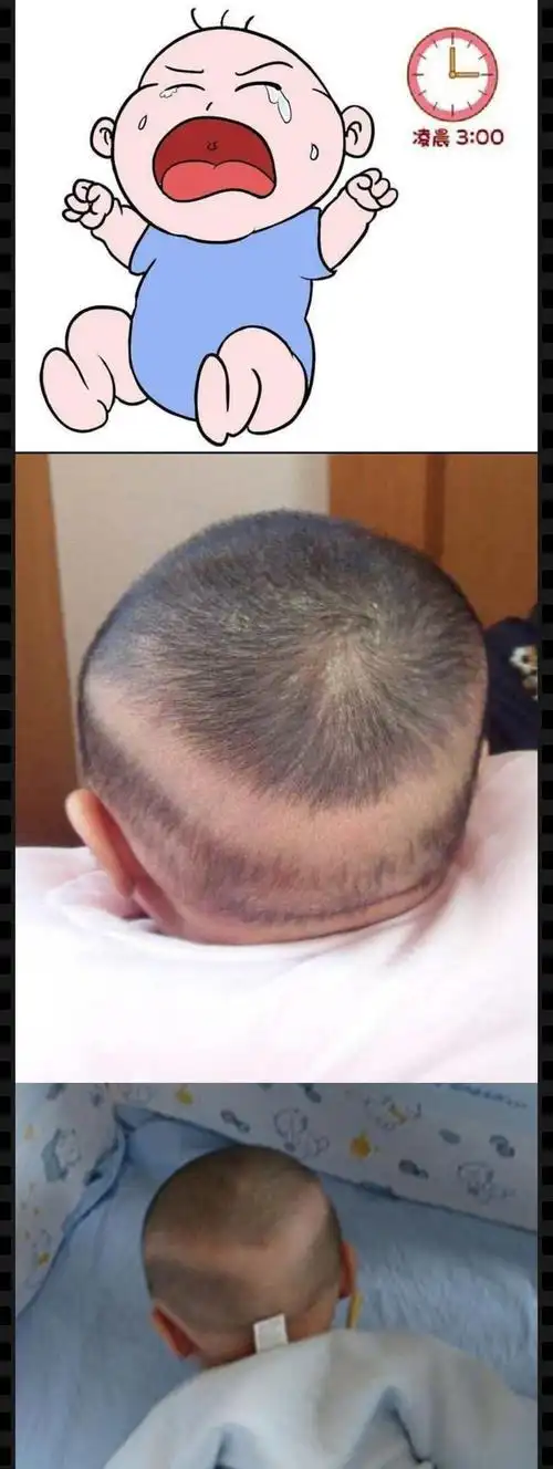 【南阳市儿童医学中心 儿二科 张龙】,小儿佝偻病你了解多少呢?